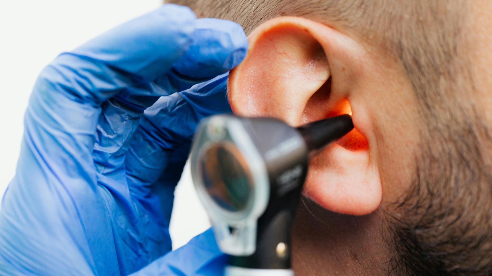 How much does it cost to get your ears cleaned in Australia?