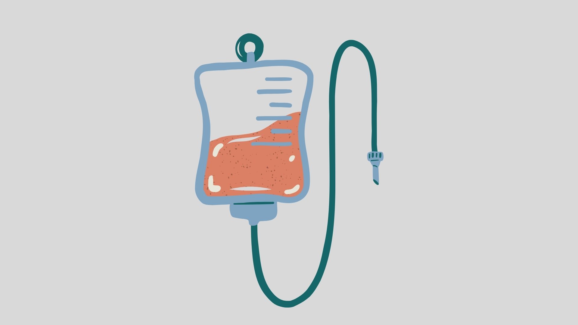 How Much Does an Iron IV Infusion Cost?