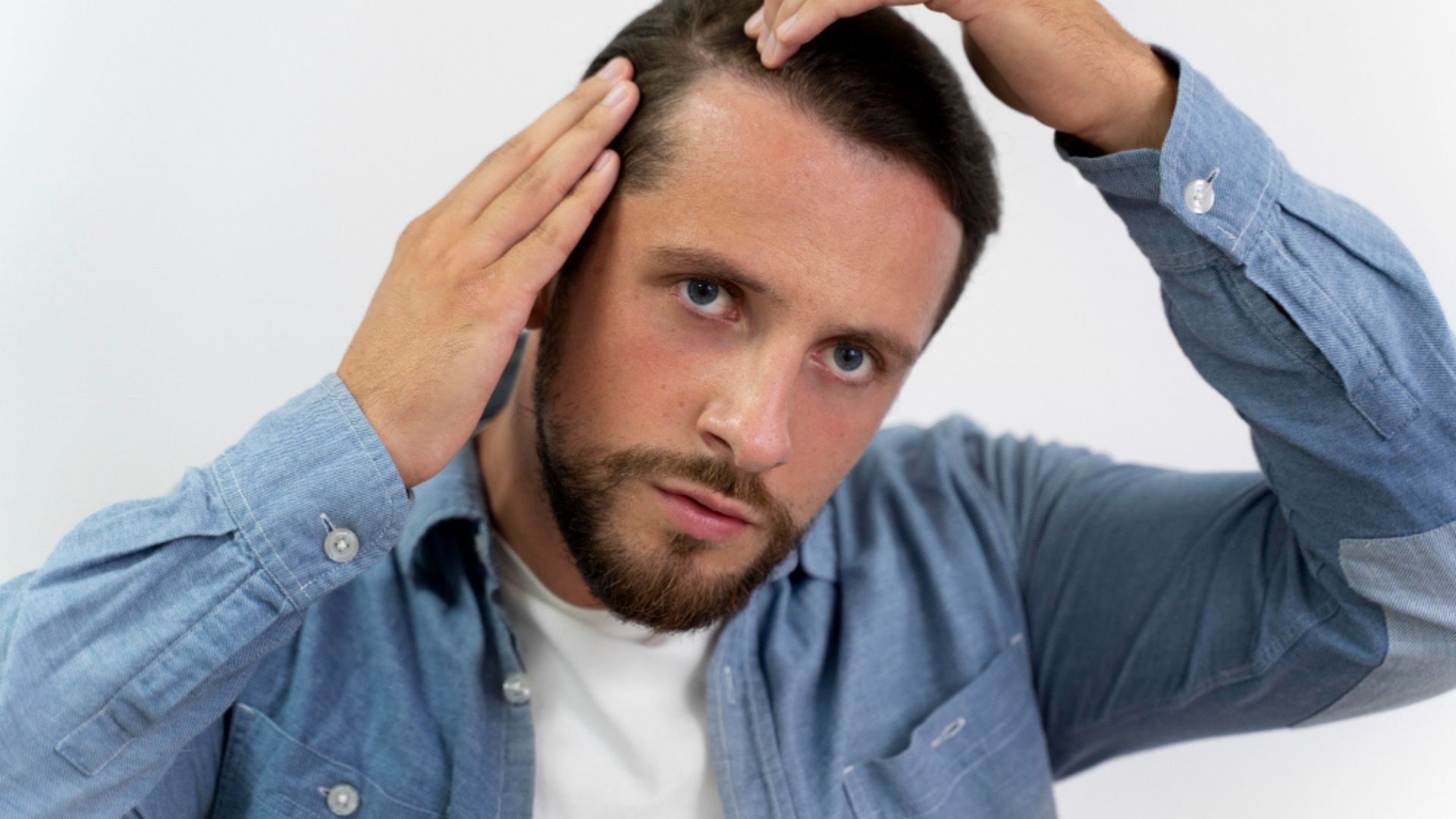 Male Hair Loss