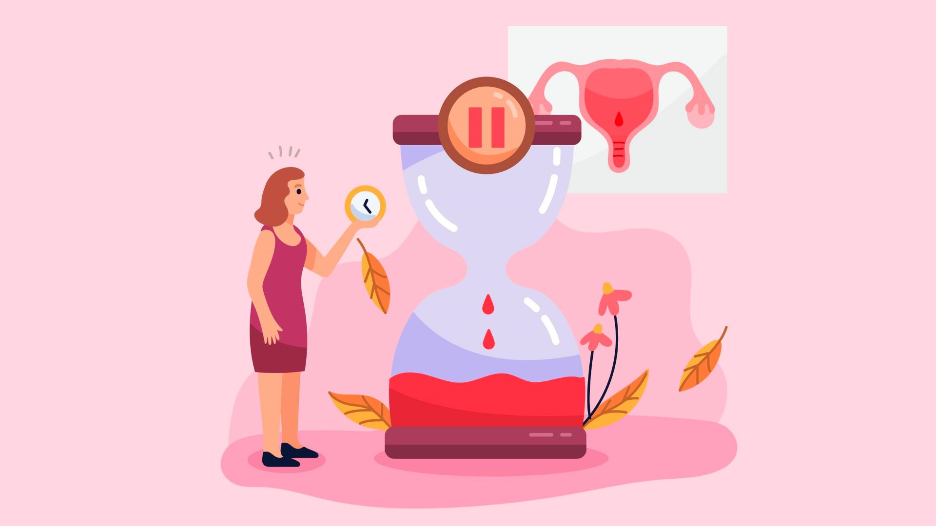 PCOS and Infertility